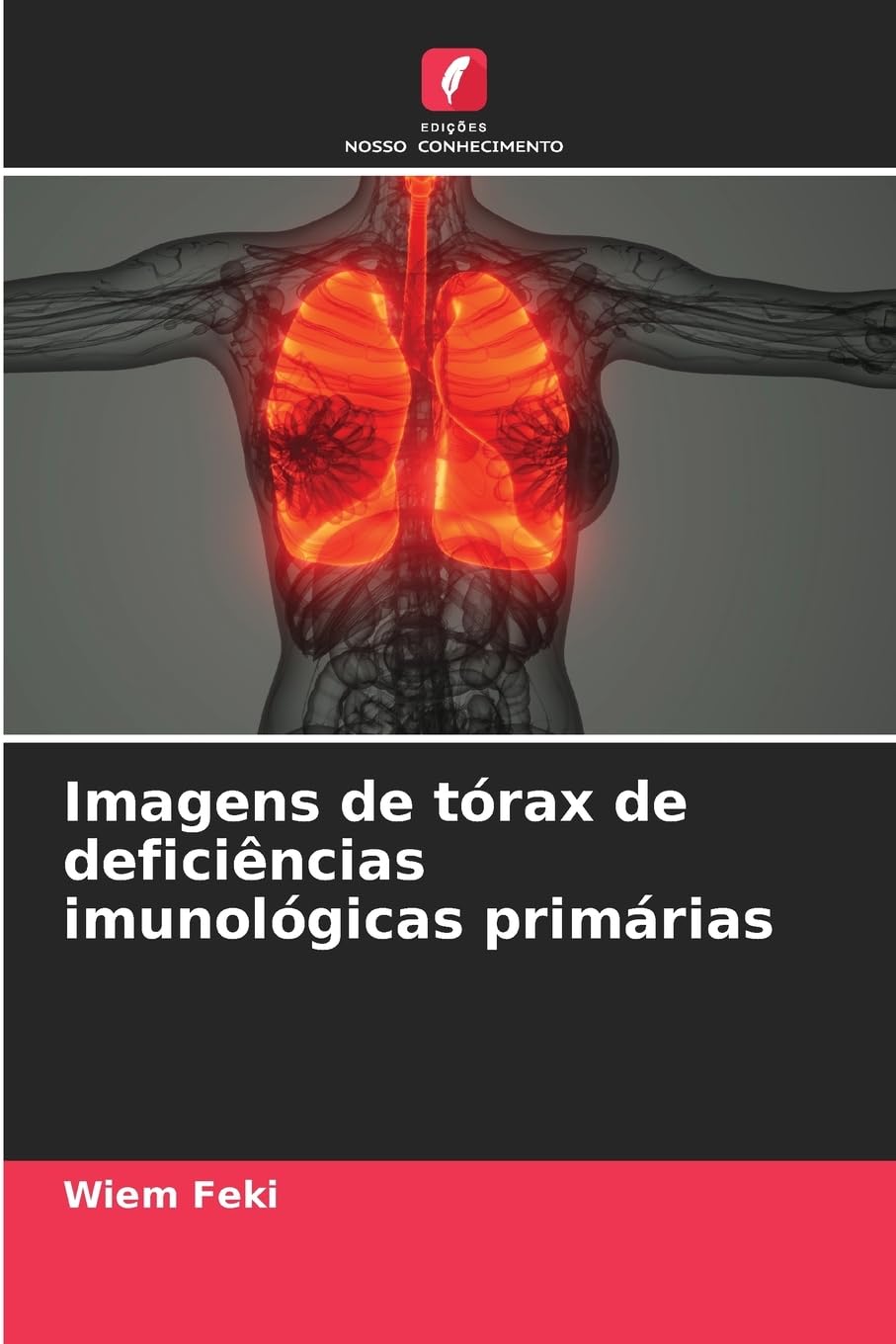 Imagens de tórax de deficiências imunológicas primárias Books