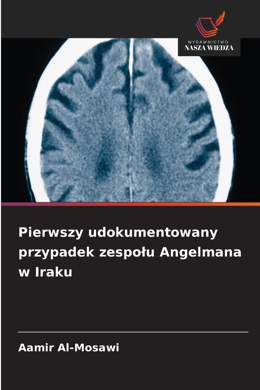 Pierwszy udokumentowany przypadek zespo¿u Angelmana w Iraku Medicine