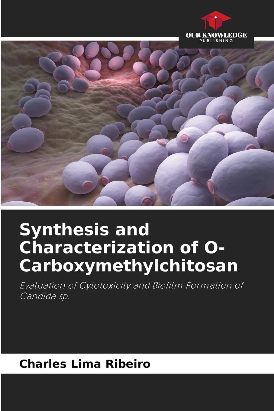 Synthesis and Characterization of O-Carboxymethylchitosan Natural Sciences