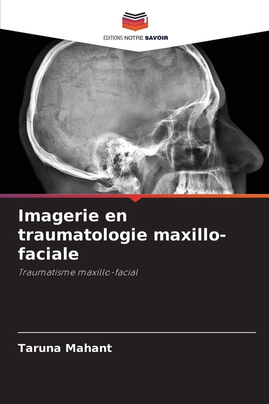 Imagerie en traumatologie maxillo-faciale Medicine