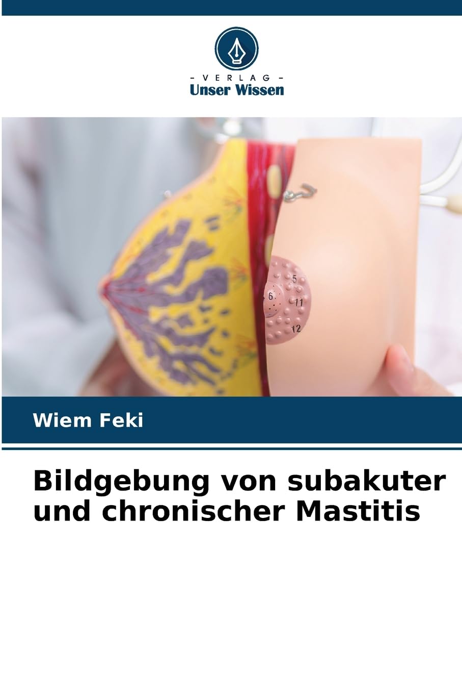 Bildgebung von subakuter und chronischer Mastitis Books