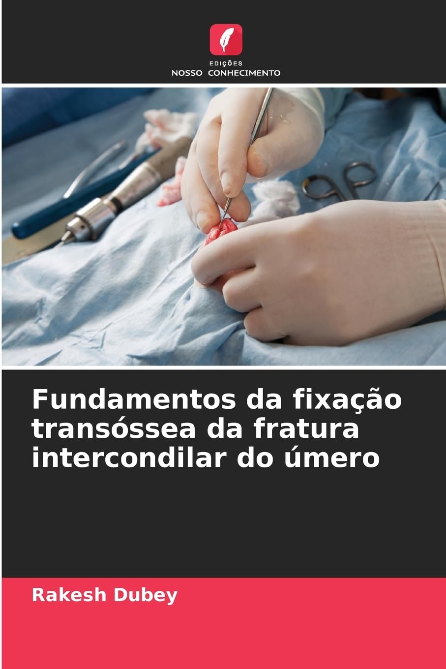 Fundamentos da fixação transóssea da fratura intercondilar do úmero Medicine