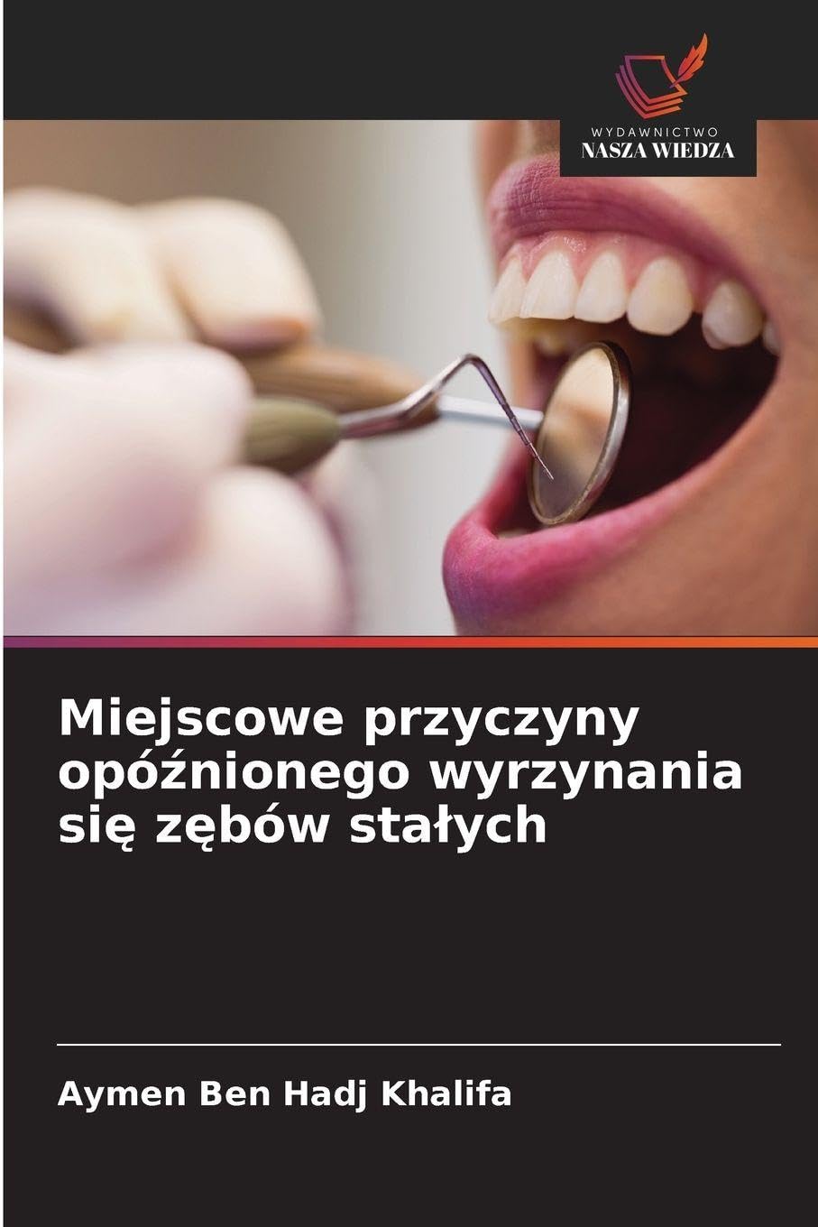 Miejscowe przyczyny opó¿nionego wyrzynania si¿ z¿bów sta¿ych Medicine