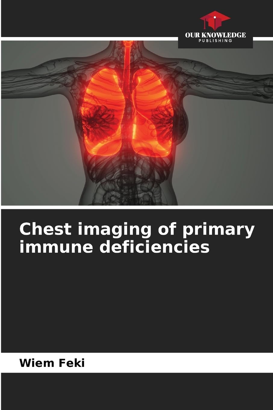 Chest imaging of primary immune deficiencies Books