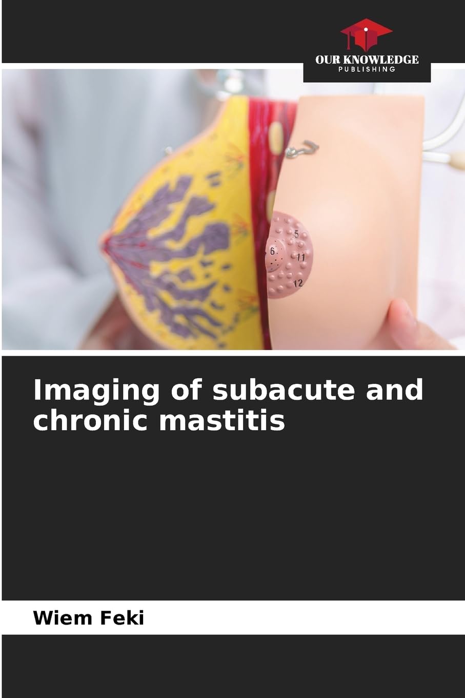 Imaging of subacute and chronic mastitis Books