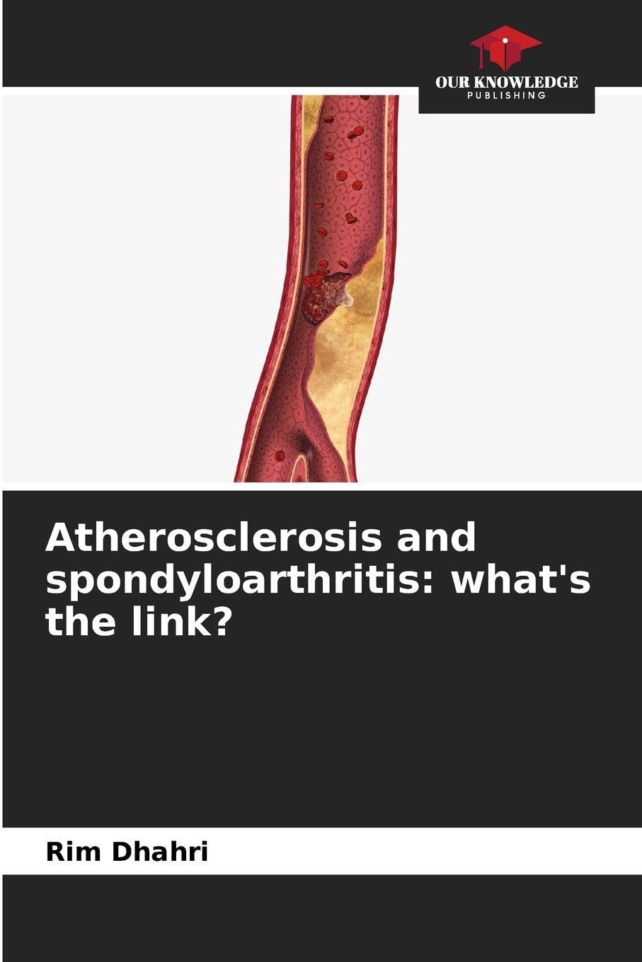 Atherosclerosis and spondyloarthritis: what's the link? Medicine