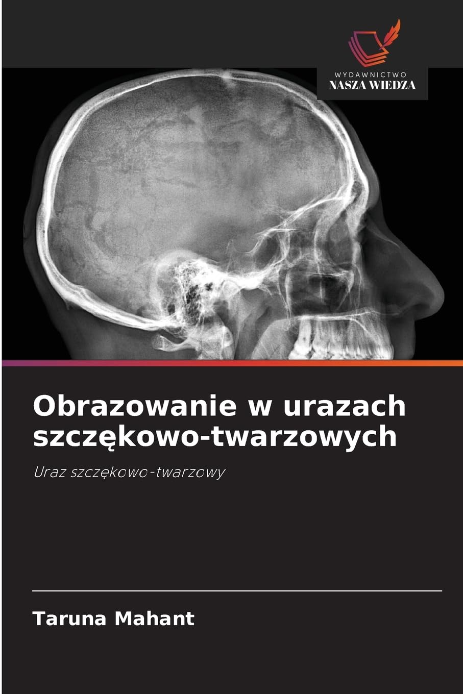 Obrazowanie w urazach szcz¿kowo-twarzowych Medicine