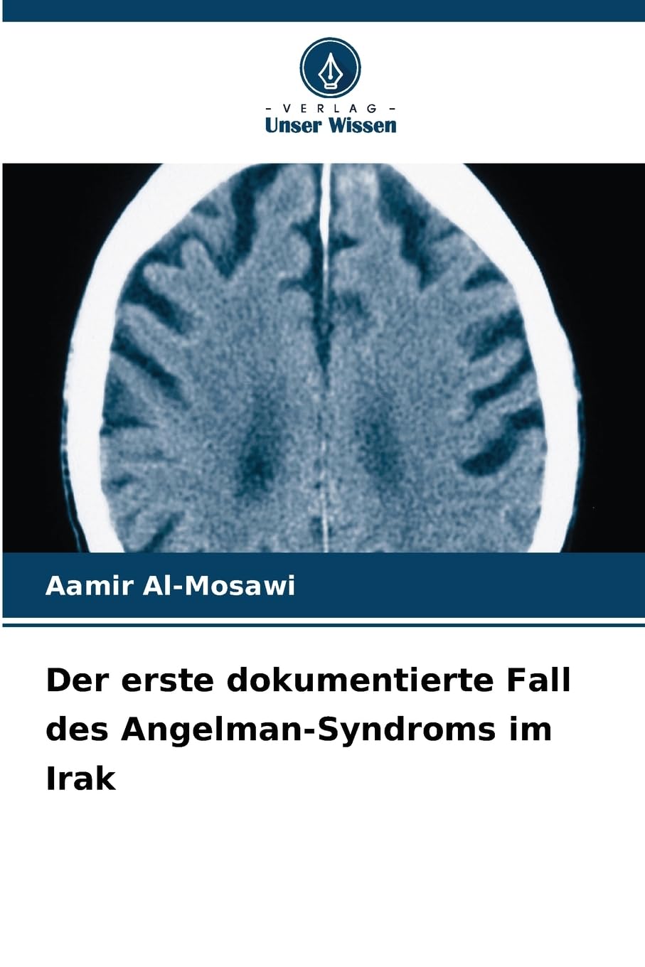 Der erste dokumentierte Fall des Angelman-Syndroms im Irak Medicine