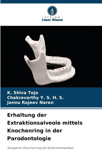 Erhaltung der Extraktionsalveole mittels Knochenring in der Parodontologie Medicine