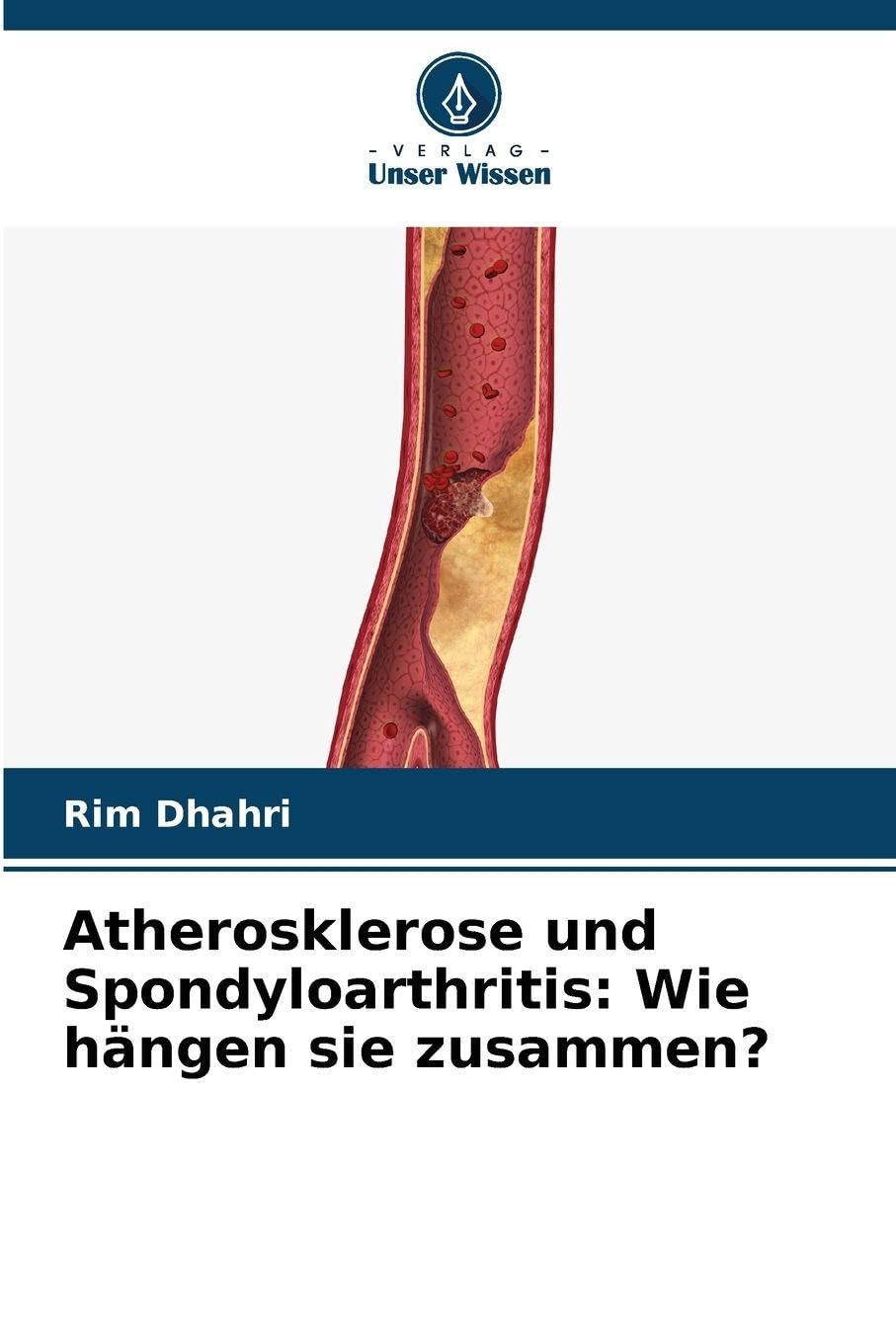 Atherosklerose und Spondyloarthritis: Wie hängen sie zusammen? Medicine
