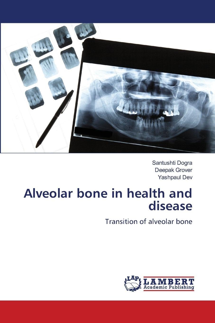 Alveolar bone in health and disease Medicine