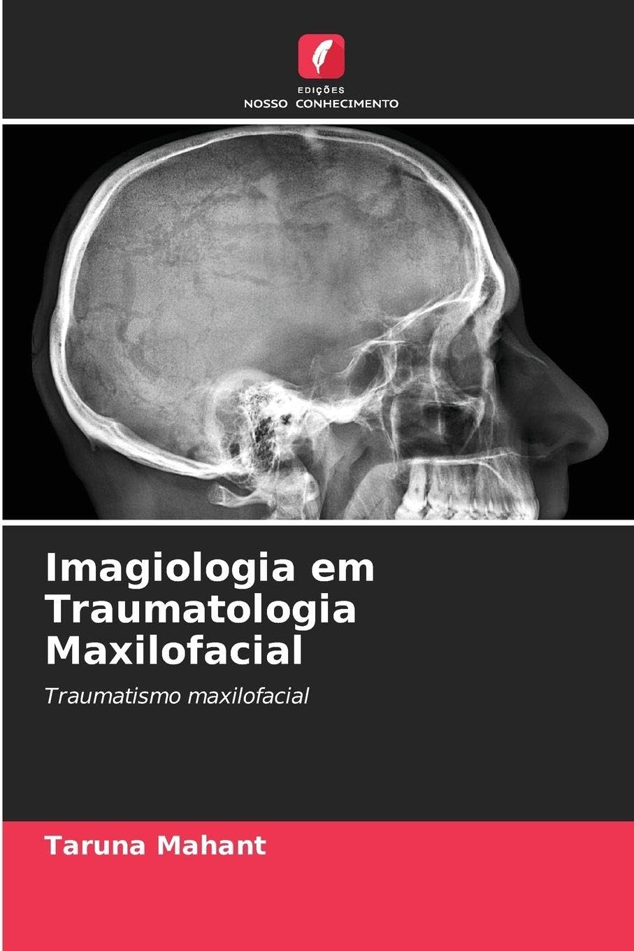 Imagiologia em Traumatologia Maxilofacial Medicine
