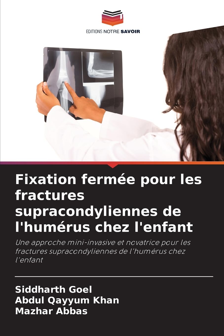 Fixation fermée pour les fractures supracondyliennes de l'humérus chez l'enfant Medicine