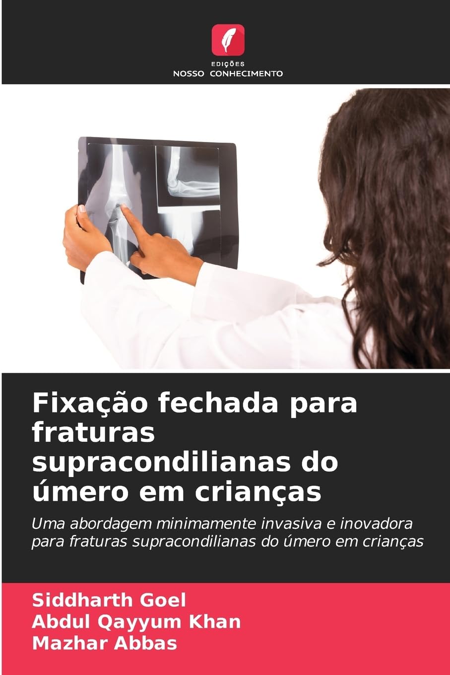 Fixação fechada para fraturas supracondilianas do úmero em crianças Medicine