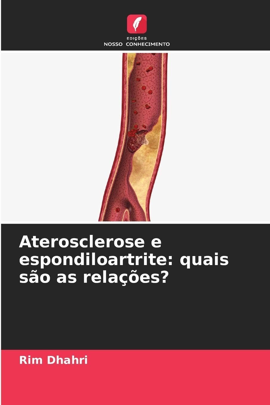 Aterosclerose e espondiloartrite: quais são as relações? Medicine