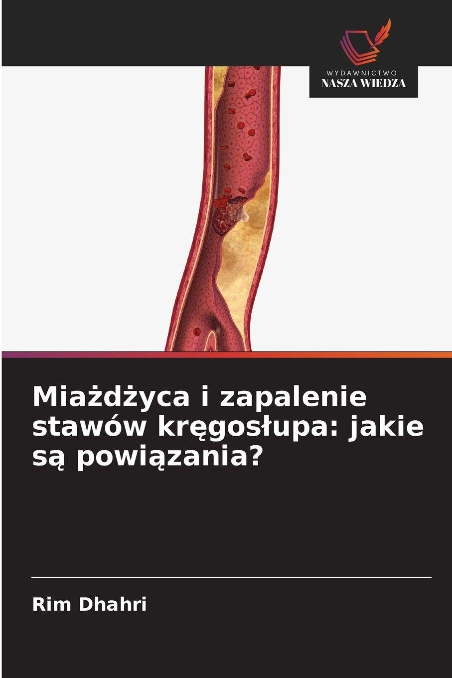 Mia¿d¿yca i zapalenie stawów kr¿gos¿upa: jakie s¿ powi¿zania? Medicine