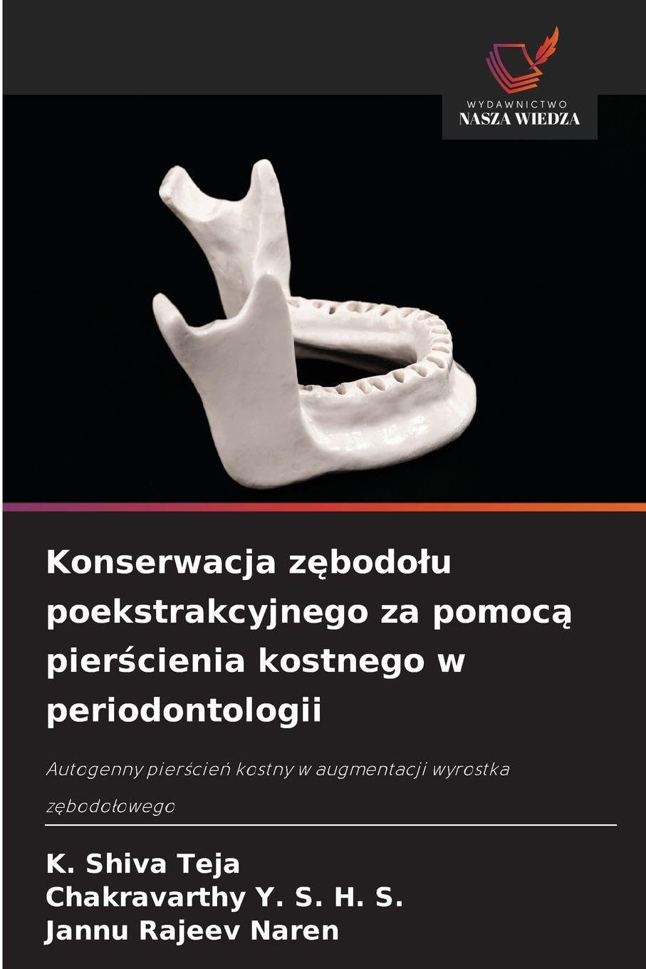 Konserwacja z¿bodo¿u poekstrakcyjnego za pomoc¿ pier¿cienia kostnego w periodontologii Medicine
