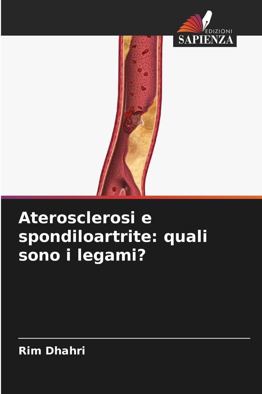 Aterosclerosi e spondiloartrite: quali sono i legami? Medicine