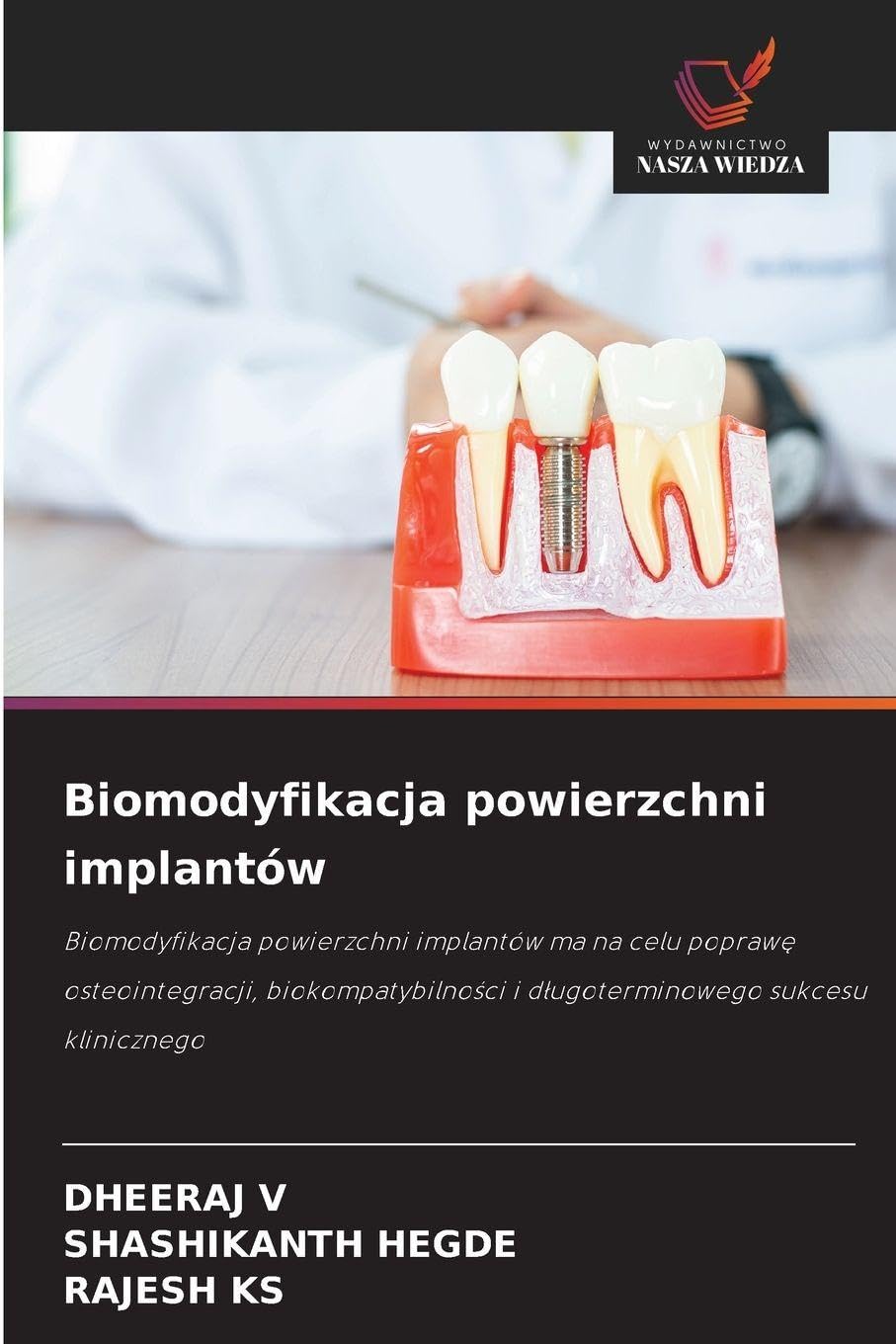 Biomodyfikacja powierzchni implantów Law