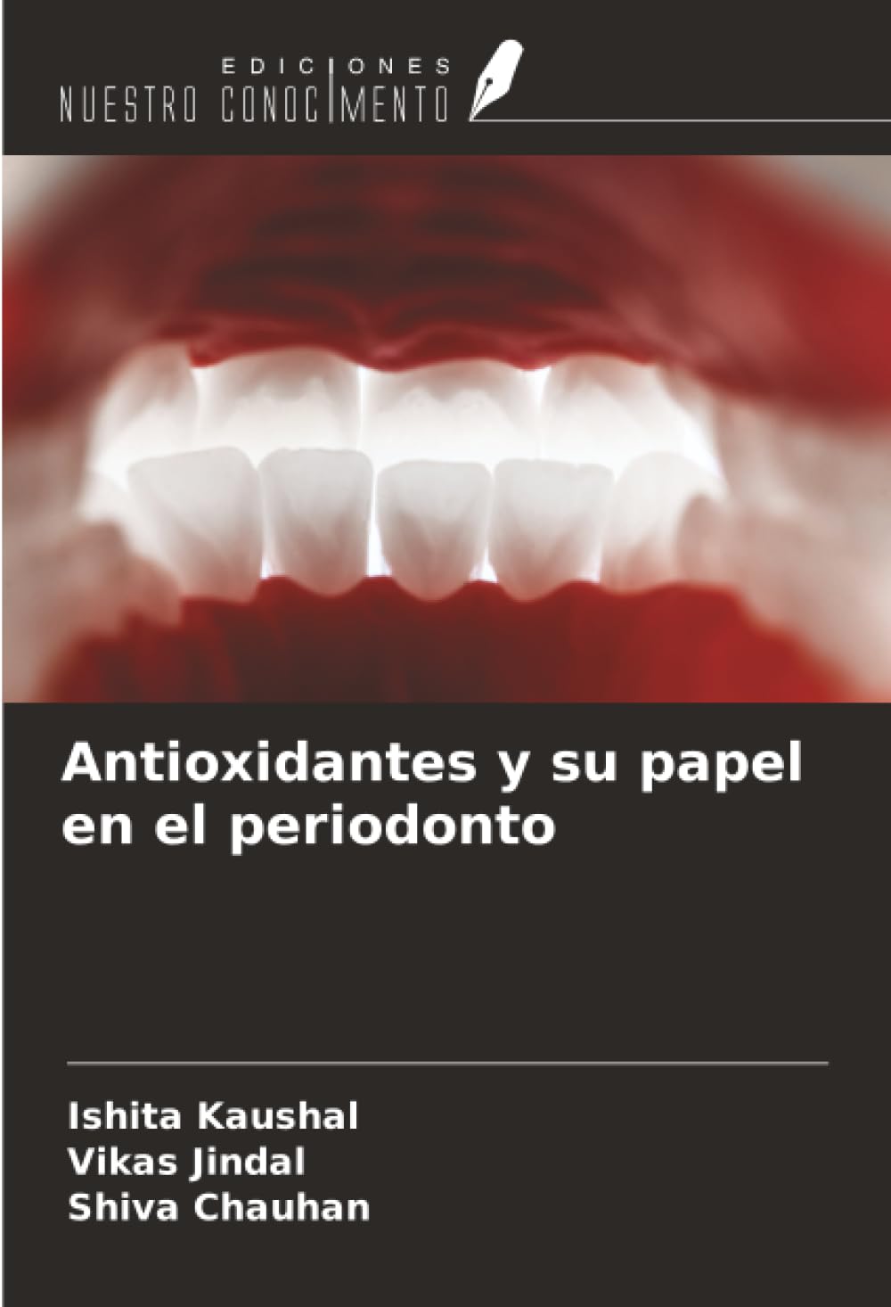 Antioxidantes y su papel en el periodonto Medicine