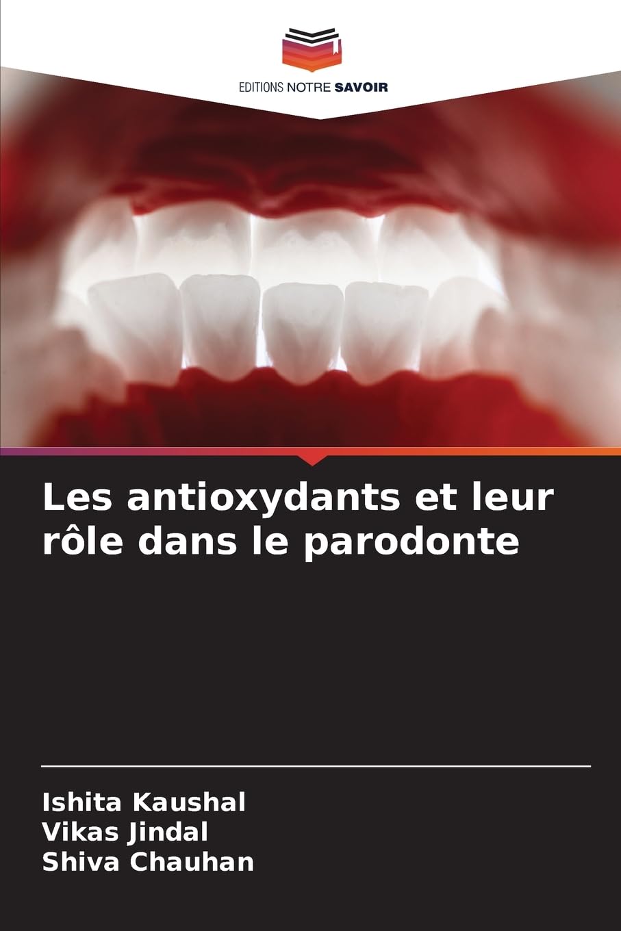 Les antioxydants et leur rôle dans le parodonte Medicine