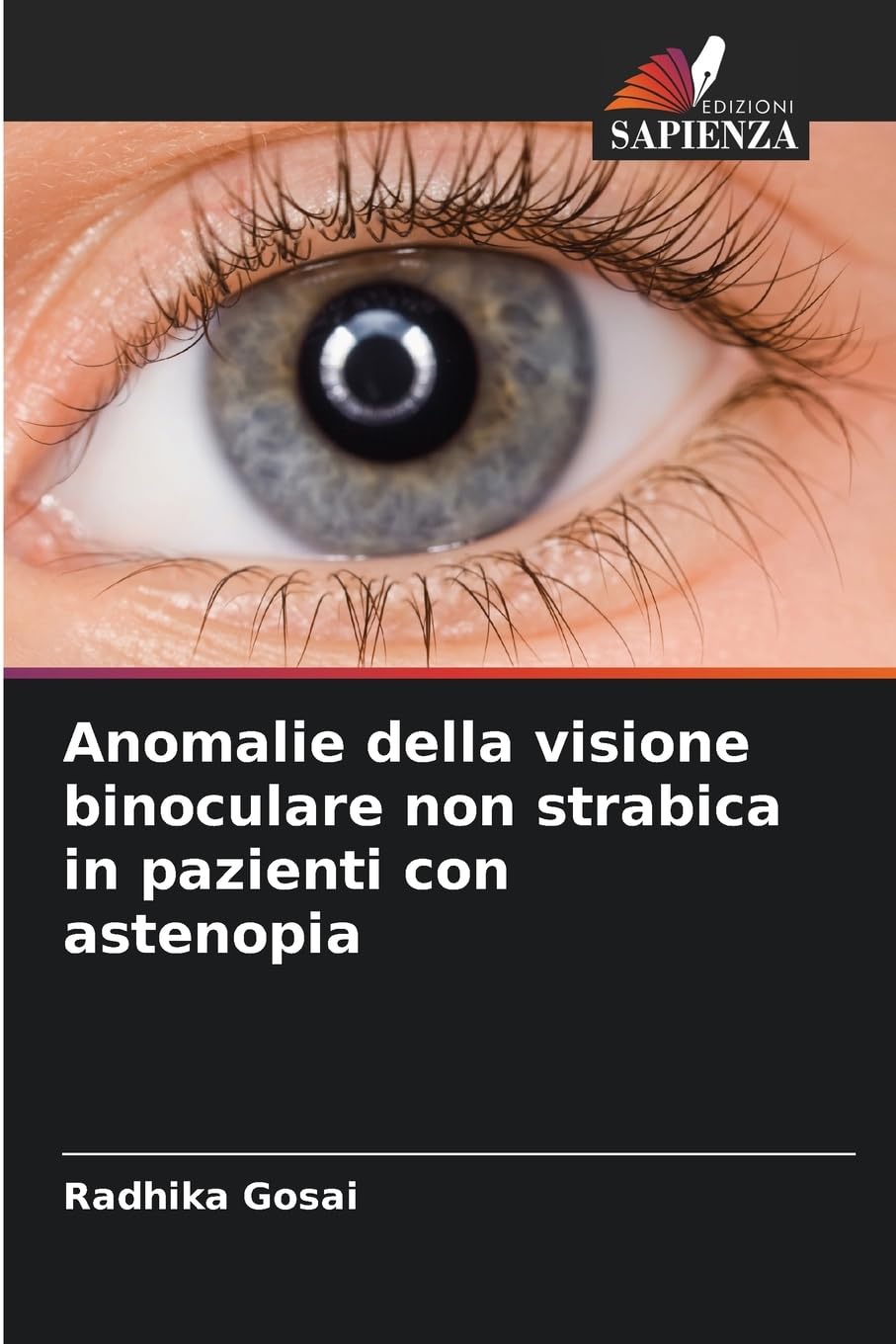 Anomalie della visione binoculare non strabica in pazienti con astenopia Medicine