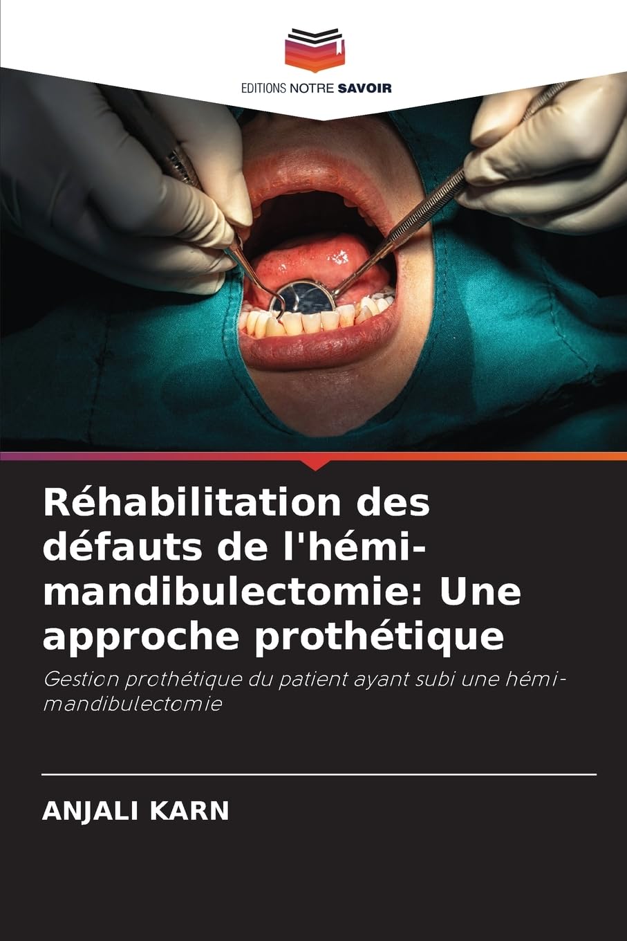 Réhabilitation des défauts de l'hémi-mandibulectomie: Une approche prothétique Medicine