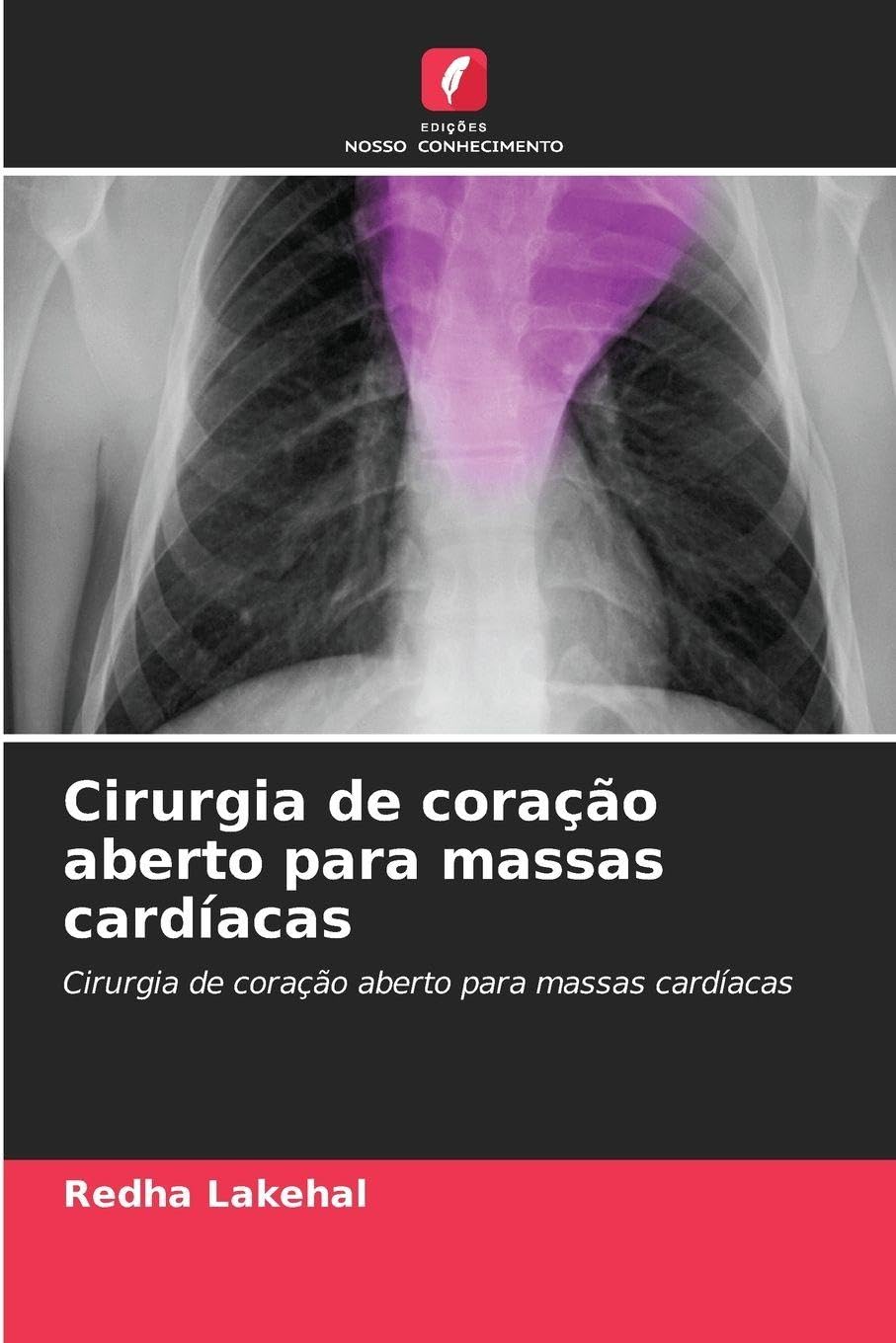 Cirurgia de coração aberto para massas cardíacas Medicine