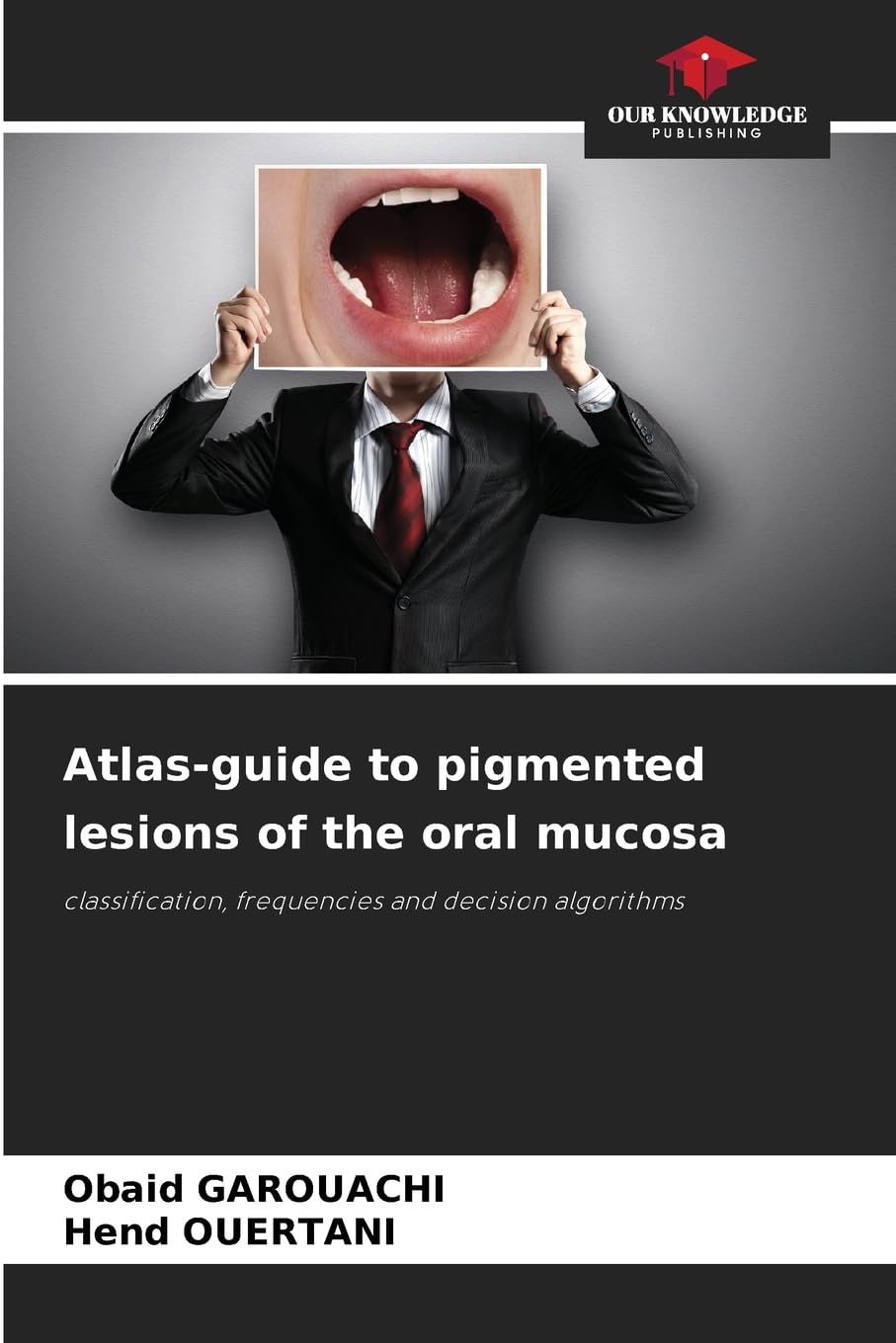 Atlas-guide to pigmented lesions of the oral mucosa Medicine