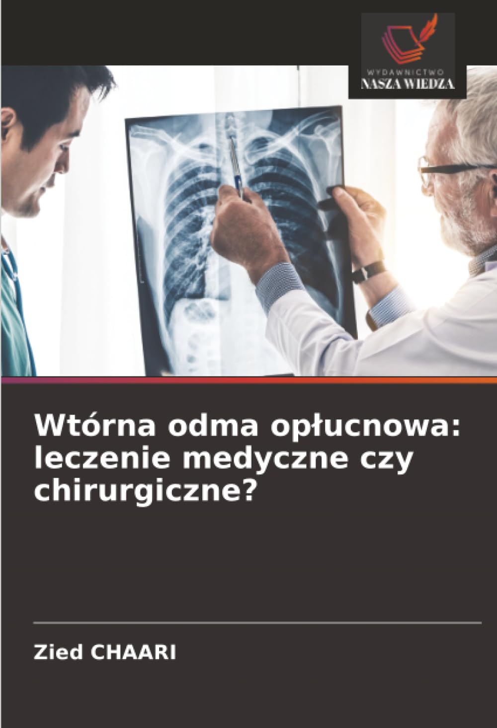 Wtórna odma op¿ucnowa: leczenie medyczne czy chirurgiczne? Medicine