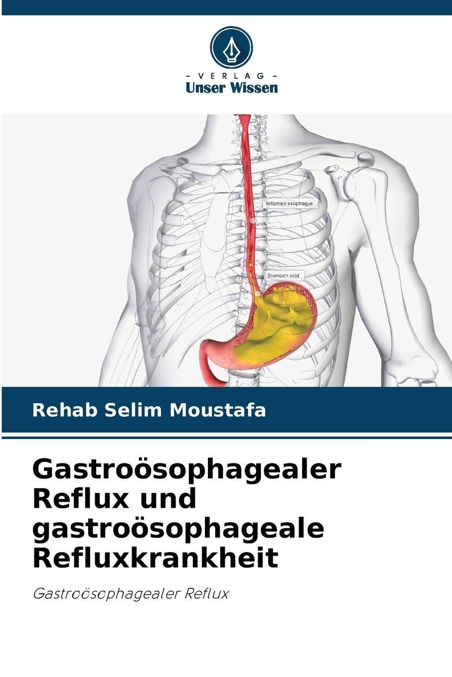 Gastroösophagealer Reflux und gastroösophageale Refluxkrankheit Law