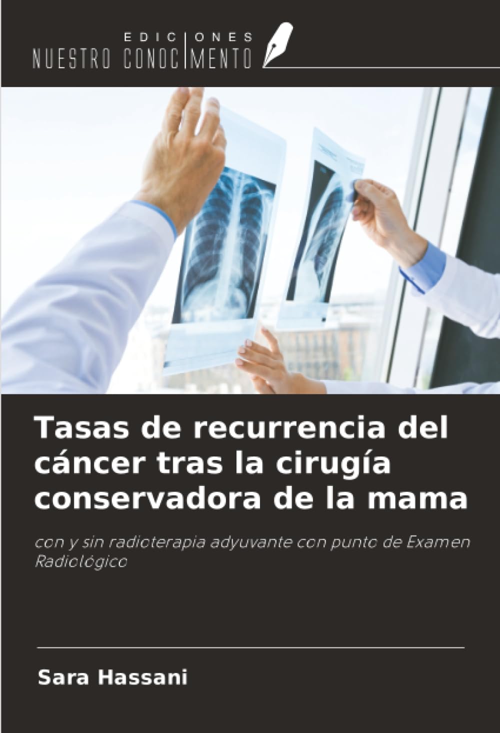 Tasas de recurrencia del cáncer tras la cirugía conservadora de la mama Medicine