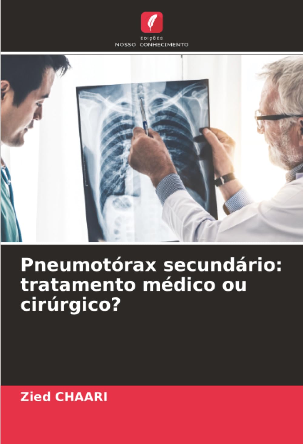 Pneumotórax secundário: tratamento médico ou cirúrgico? Medicine