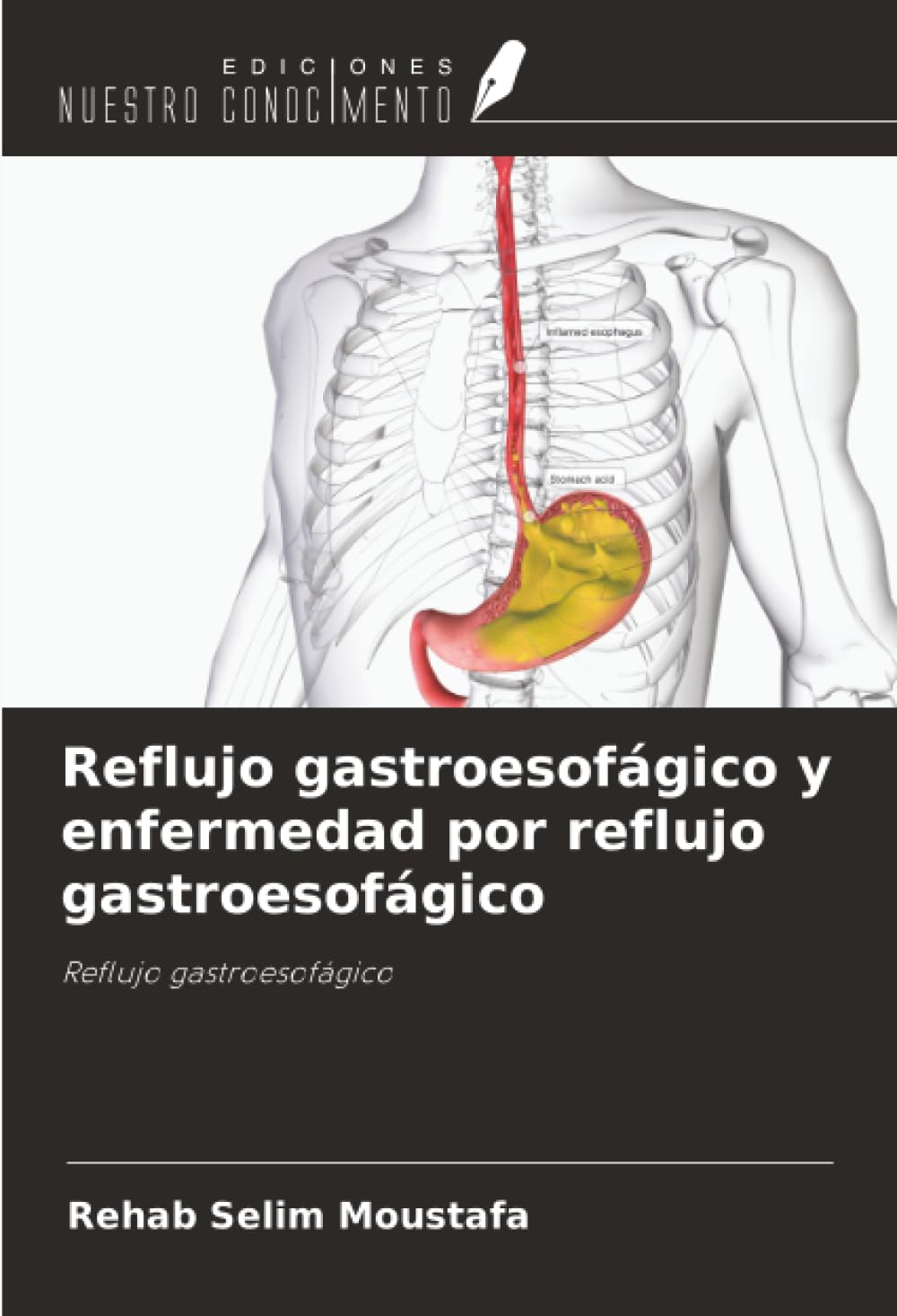 Reflujo gastroesofágico y enfermedad por reflujo gastroesofágico Law