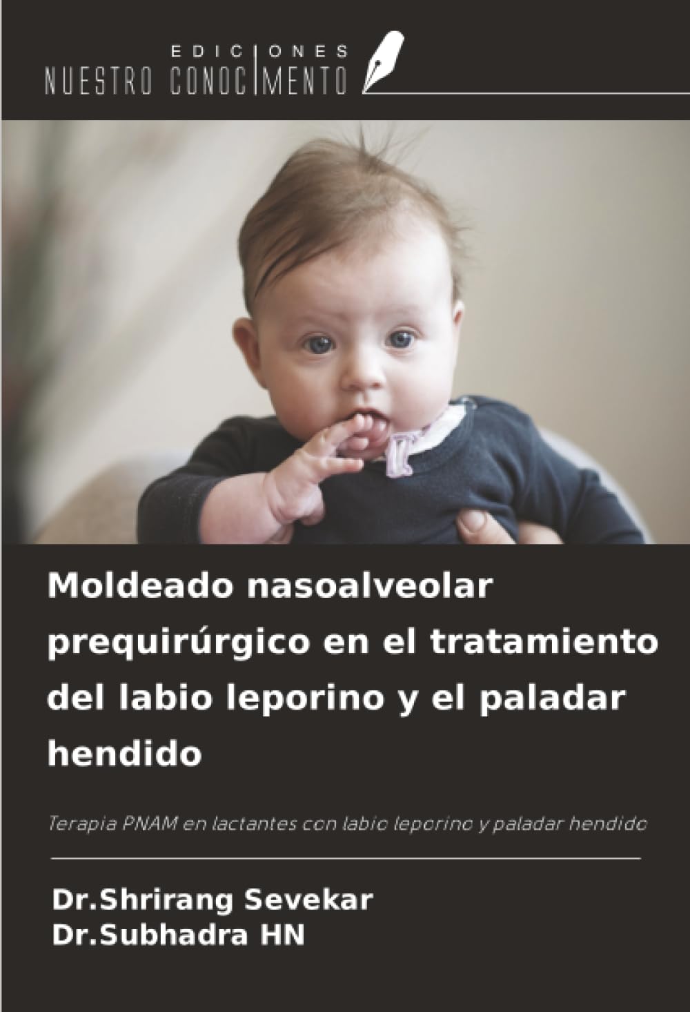 Moldeado nasoalveolar prequirúrgico en el tratamiento del labio leporino y el paladar hendido Medicine