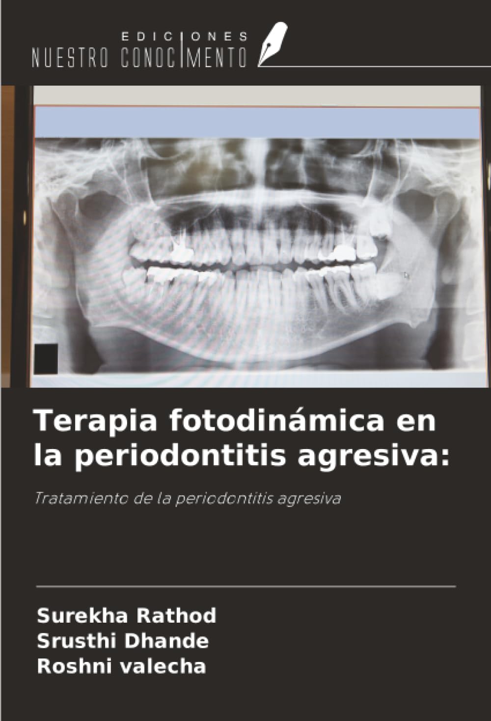 Terapia fotodinámica en la periodontitis agresiva: Medicine