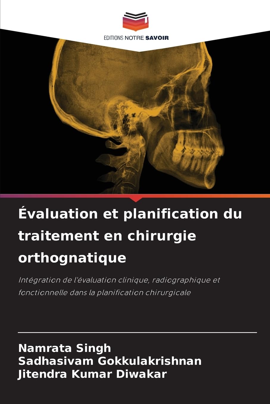 Évaluation et planification du traitement en chirurgie orthognatique Medicine