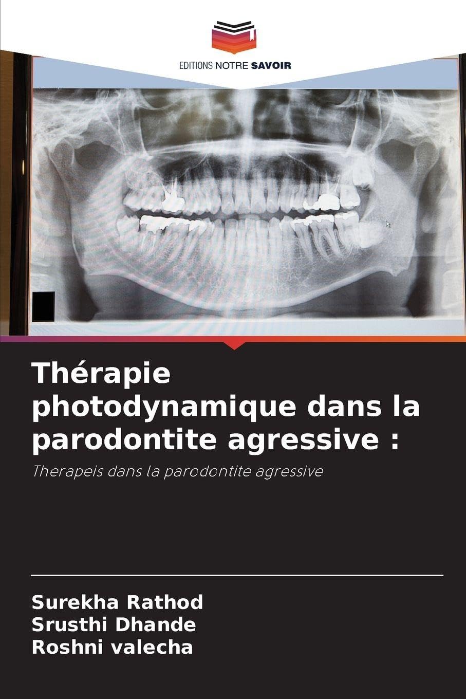 Thérapie photodynamique dans la parodontite agressive : Medicine