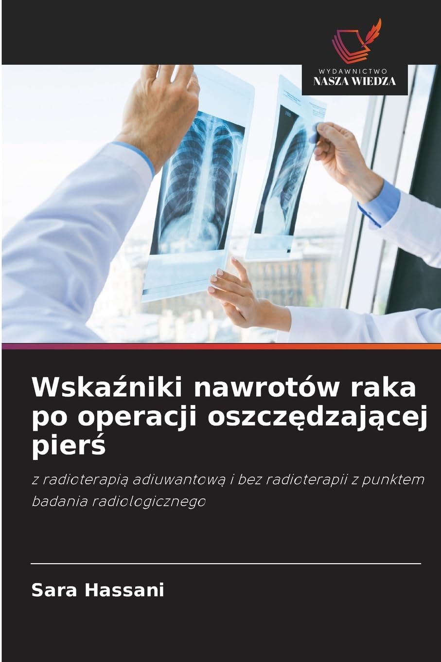 Wska¿niki nawrotów raka po operacji oszcz¿dzaj¿cej pier¿ Medicine