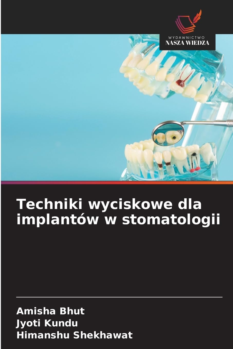 Techniki wyciskowe dla implantów w stomatologii Medicine
