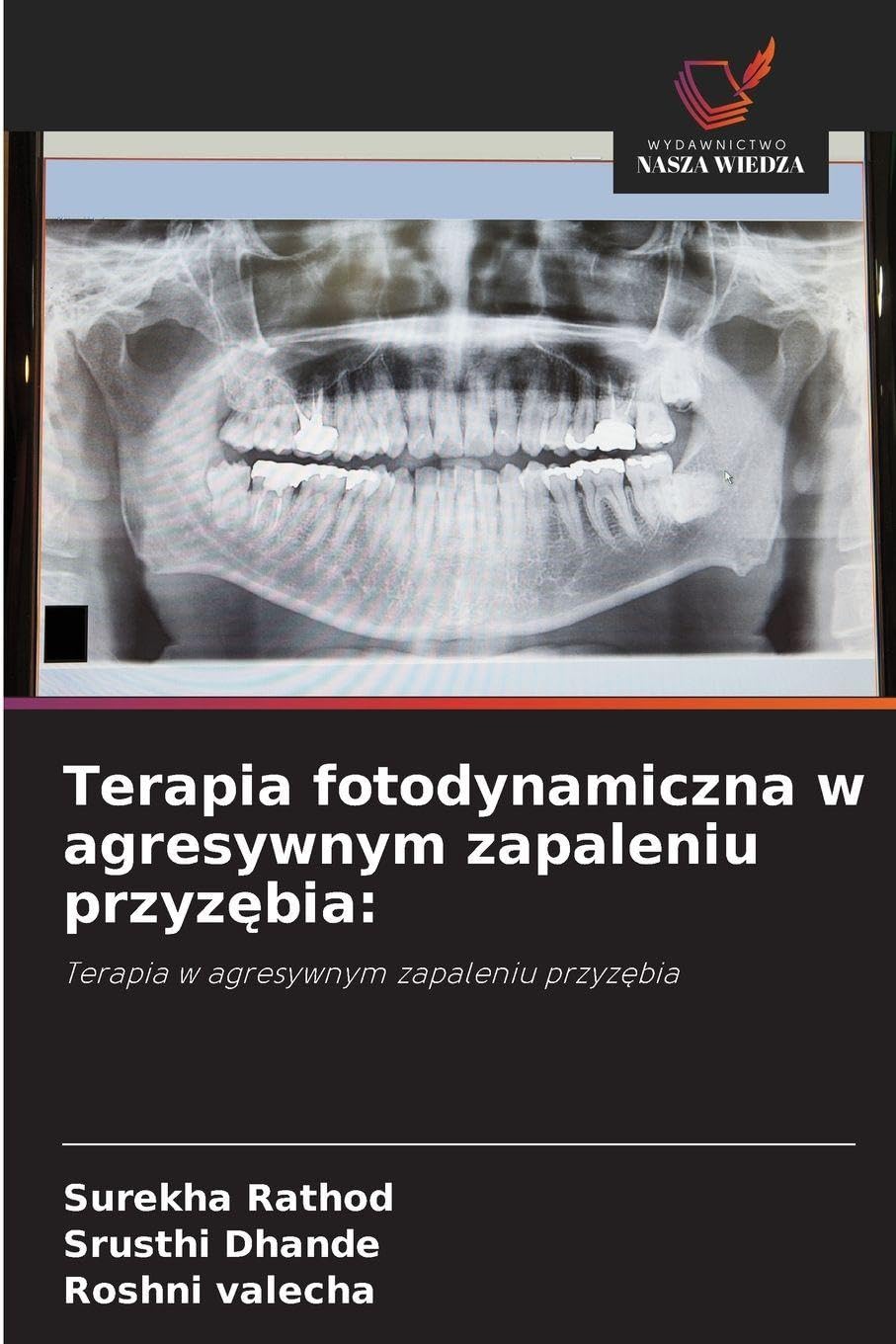 Terapia fotodynamiczna w agresywnym zapaleniu przyz¿bia: Medicine