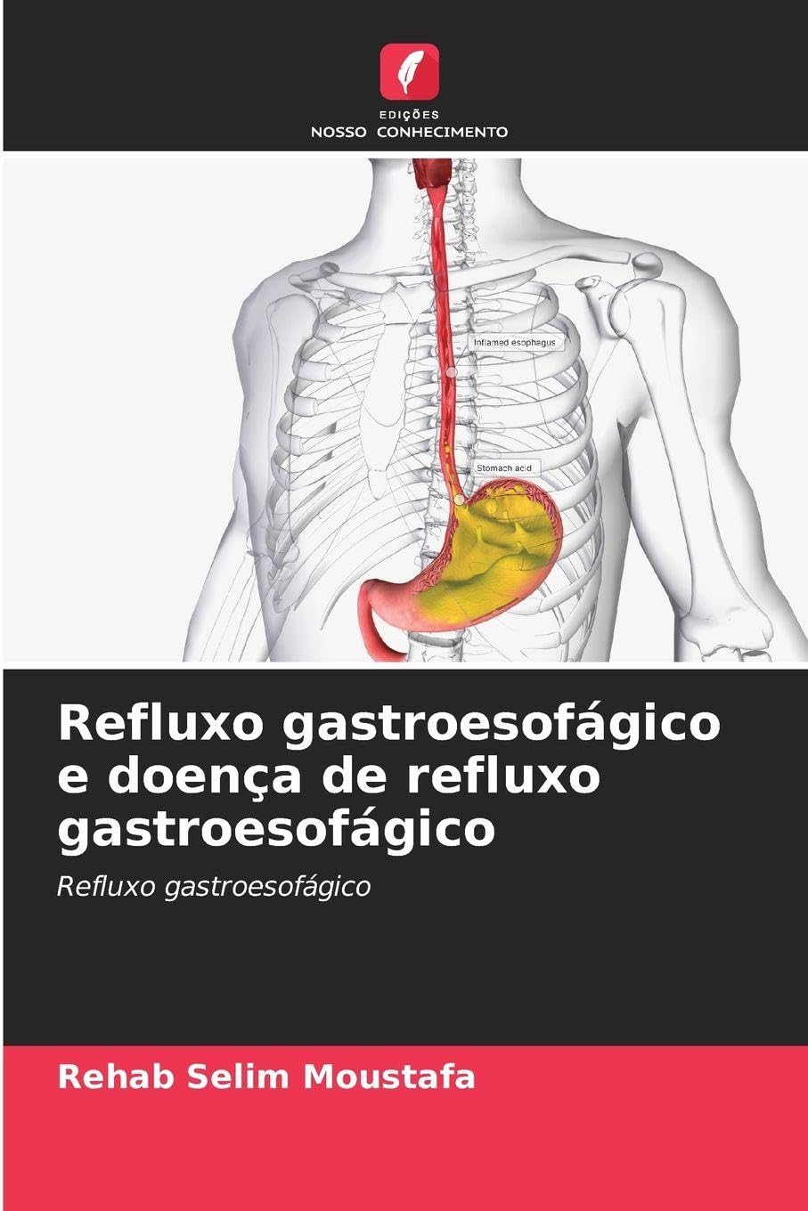 Refluxo gastroesofágico e doença de refluxo gastroesofágico Law