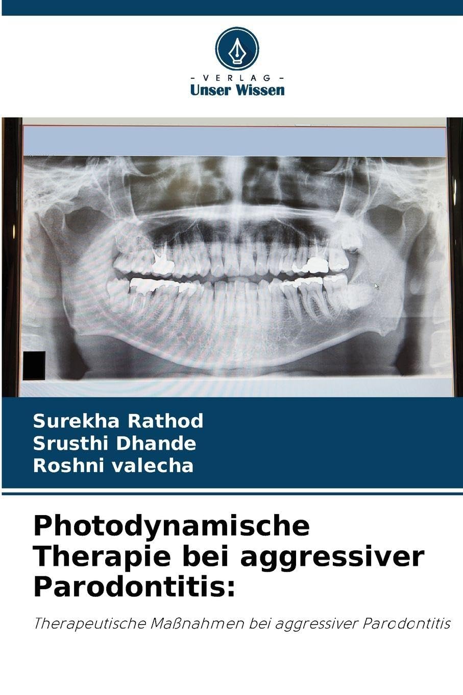 Photodynamische Therapie bei aggressiver Parodontitis: Medicine