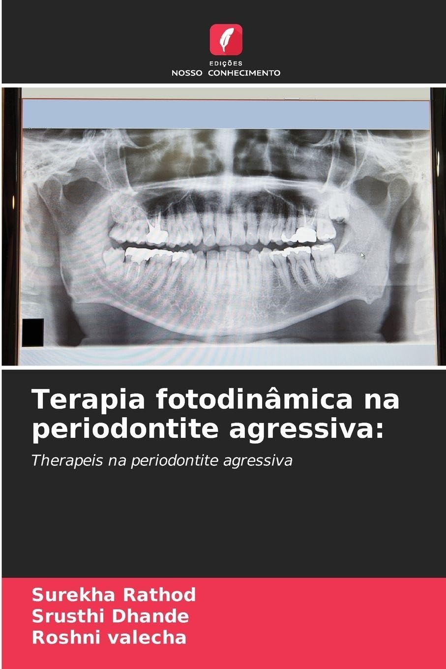 Terapia fotodinâmica na periodontite agressiva: Medicine