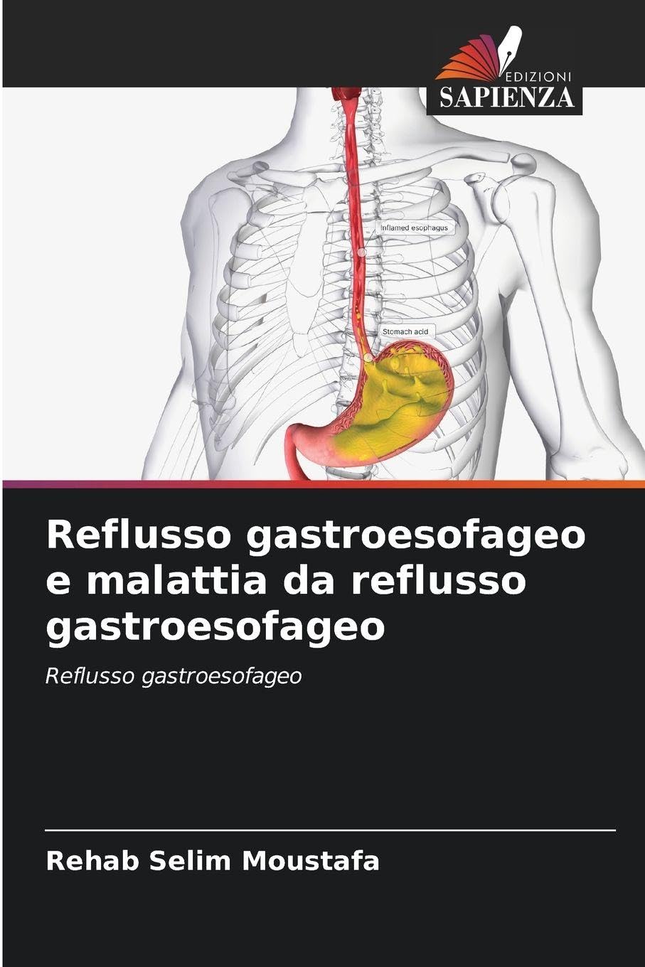 Reflusso gastroesofageo e malattia da reflusso gastroesofageo Law