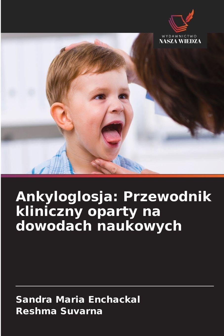 Ankyloglosja: Przewodnik kliniczny oparty na dowodach naukowych Medicine