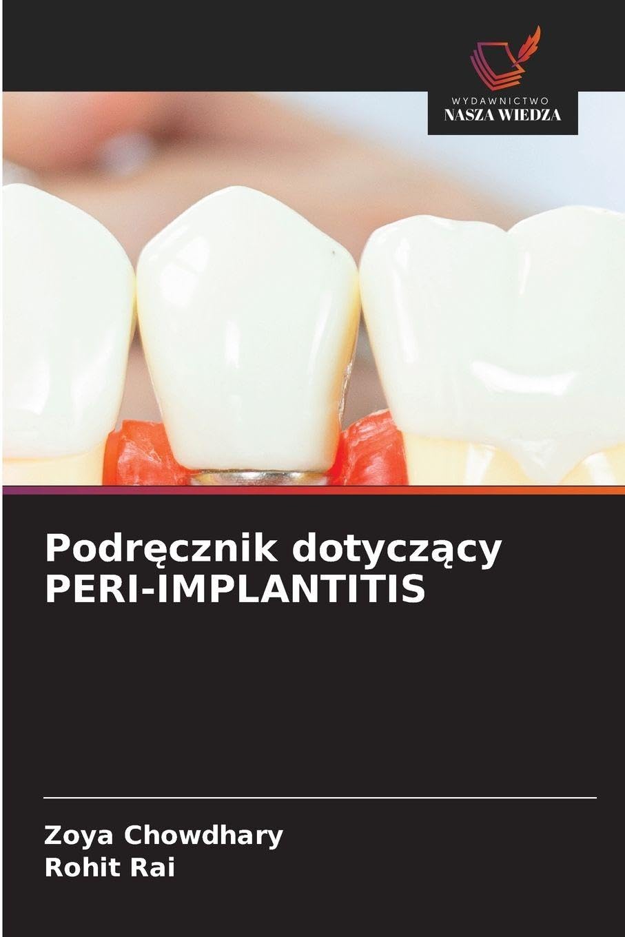 Podr¿cznik dotycz¿cy PERI-IMPLANTITIS Medicine