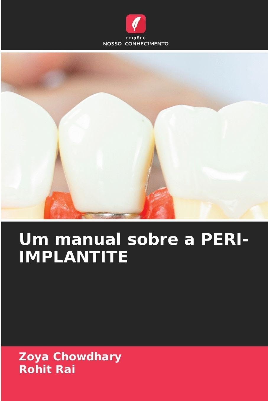 Um manual sobre a PERI-IMPLANTITE Medicine