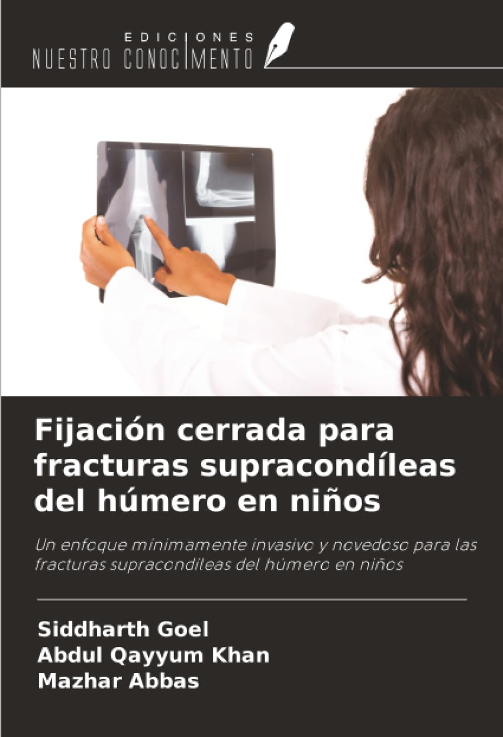 Fijación cerrada para fracturas supracondíleas del húmero en niños Medicine