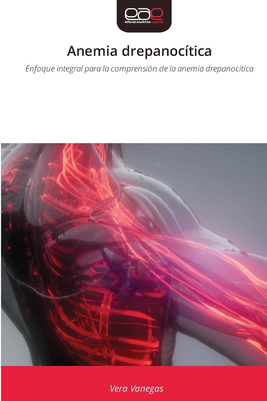 Anemia drepanocítica Medicine